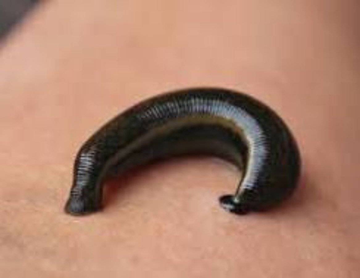 Should a parent just take it when they called a Leech from their childs partner?